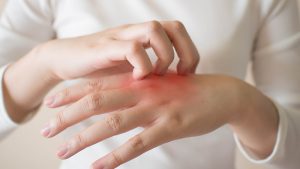 Dermatologische und thermische Wunden